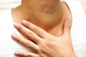 脖子出现莫名肿块,诊断后竟是第四期口腔癌!医师:出现以下症状请尽快就医检查。