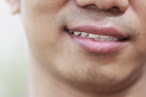 嘴唇也有癌症?医师:唇癌4大症状别轻忽