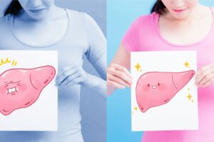 脂肪肝养出癌细胞!不想罹癌…必做3件事跟癌症断舍离!