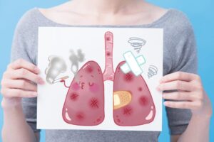 不抽烟、没有家族史,53岁妇罹“两个肺癌”!医师:6大危险因子别轻忽