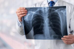 癌症登记报告出炉》女性肺癌发生人数首度超越大肠癌！乳癌、子宫体癌发生率续升