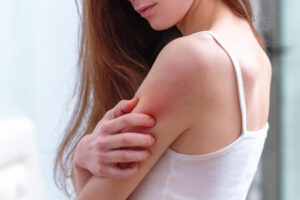 干癣性关节炎致全身性发炎，常有糖尿病、高血压共病！每天7招保养助维持病情稳定