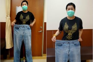 55岁成功甩肉12公斤！不吃减肥药，她靠中药、针灸健康瘦身