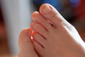 “冻甲、卷甲”痛到要命，只能拔除指甲吗？医师：恢复原样貌可以靠这招