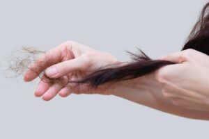 变胖、怕冷又掉头发,可能是甲状腺低下?医师:恐引多种慢性病,10症状自我检视