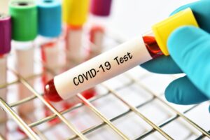 新冠肺炎》药物研发再进一步!国卫院:已完成“瑞德西韦”公克级合成