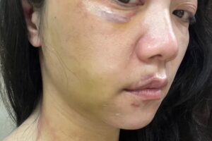 “见识人性最黑暗恐怖的一面”高嘉瑜被爆打到天亮：如果我都不能勇敢面对，其他人怎么站出来