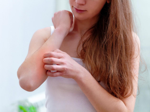 气温骤降,“寒冷性荨麻疹”恐发作!医师推4招预防全身红肿、灼热、发痒 – 大保社