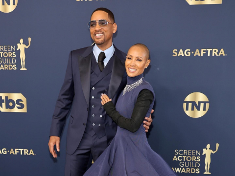 威尔史密斯护妻“生病剃光头”，被开玩笑怒揍颁奖人…医解读雄性秃、鬼剃头落发原因 – 大保社