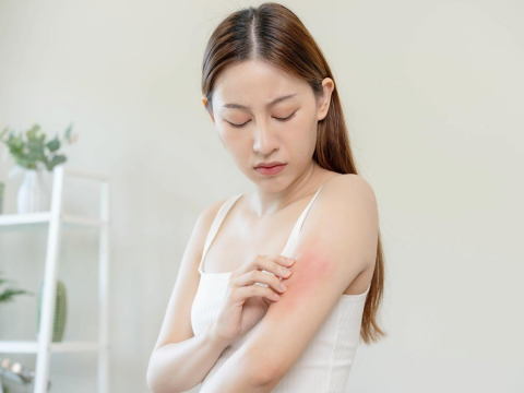 异位性皮肤炎，发炎、搔痒、发红难耐！医师图解2种治疗方式，有效止痒、改善病灶 – 大保社