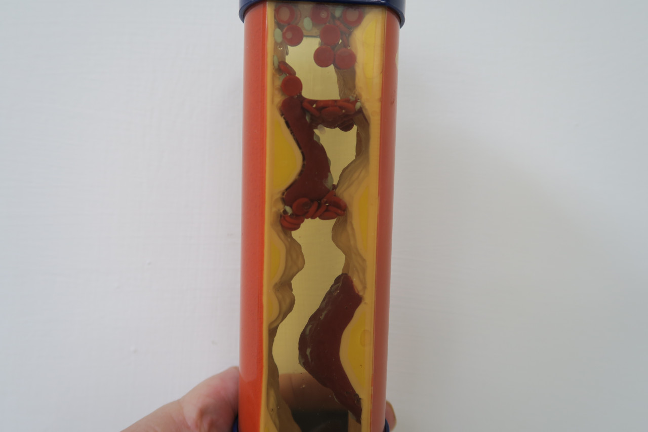 运动后胸闷“像大石压住”，他急奔医院救了自己！急性心肌梗塞“差一个念头”定生死，有7症状速就医 – 大保社