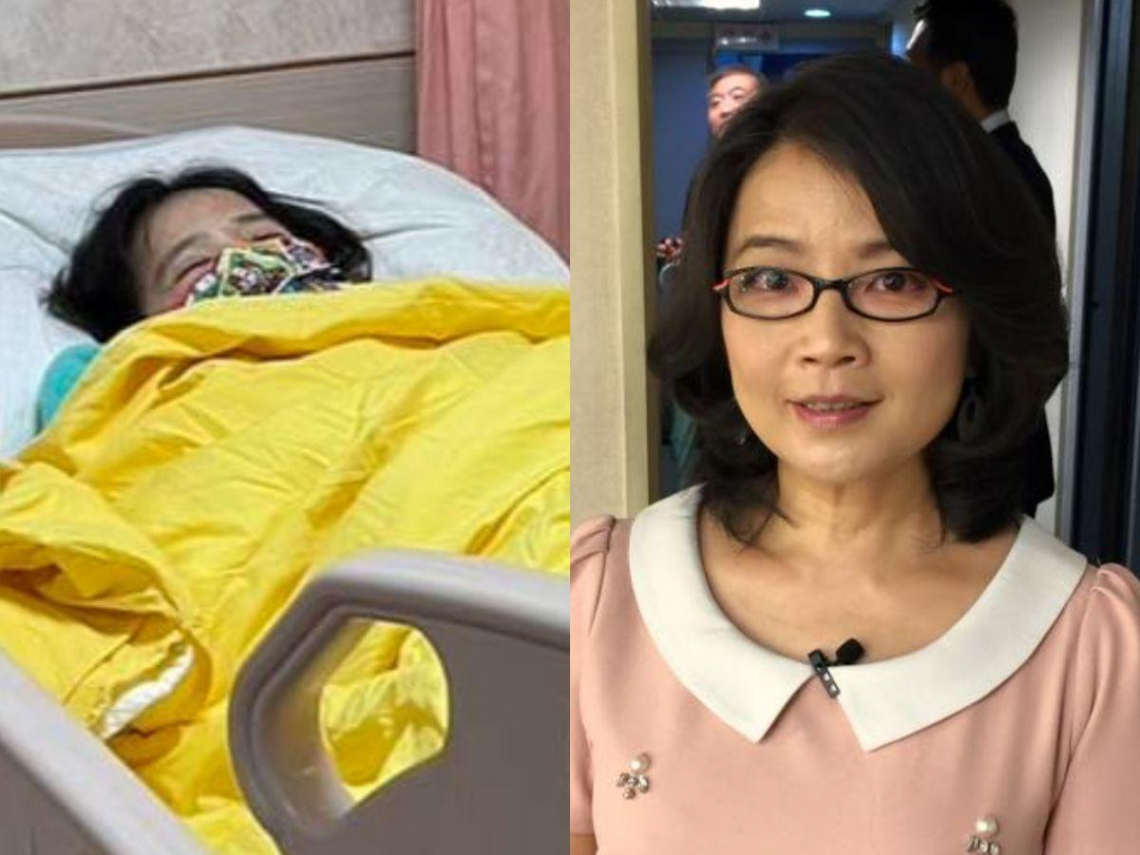 名嘴蔡玉真“发现逾1公分瘜肉”急切胆囊!胆囊癌早期不易发现,出现6大症状就要留意 – 大保社