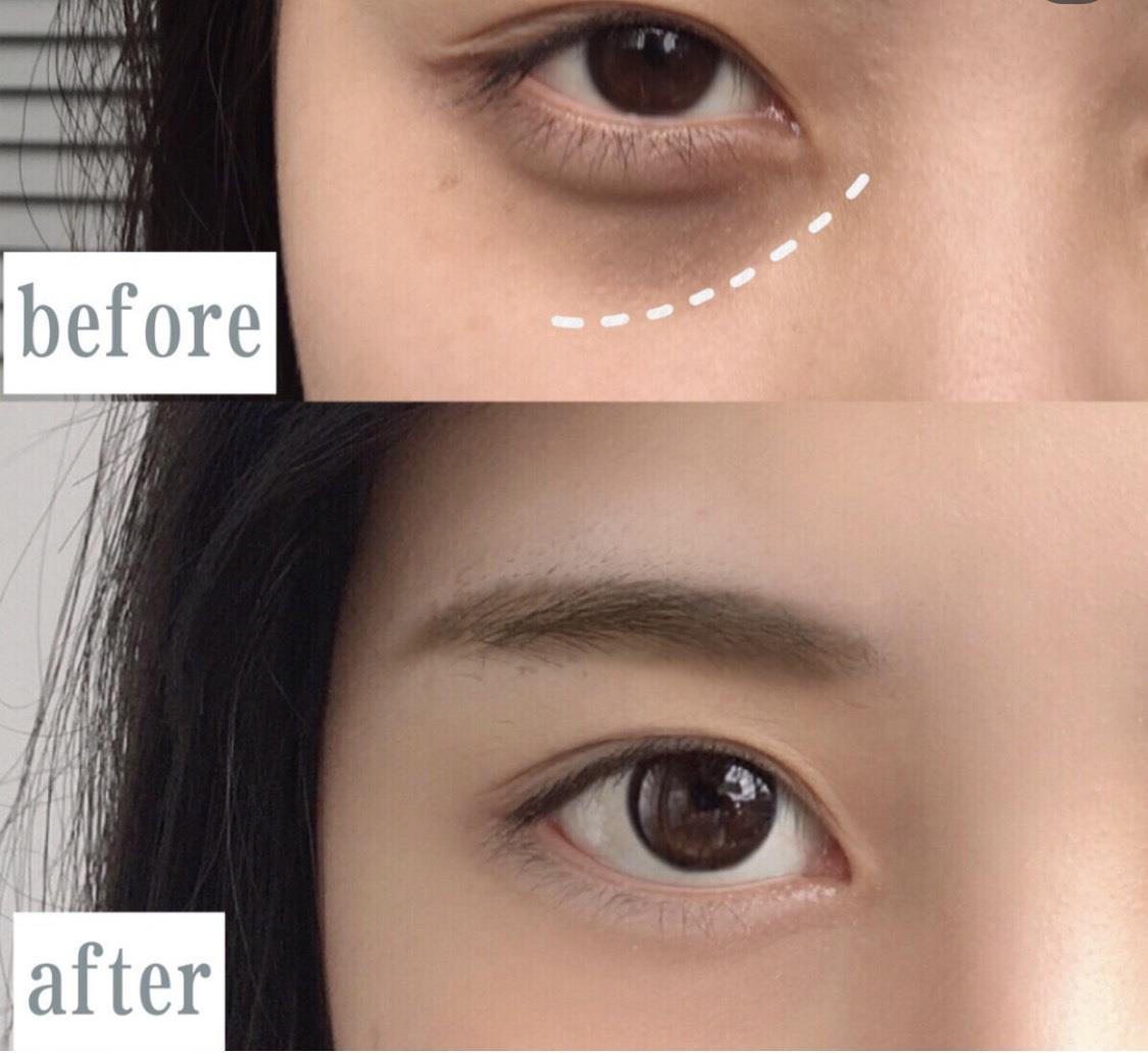 有“眼袋”别急着找医美!先改掉这些生活坏习惯,帮你维持紧致的眼周肌肤 内容图2 女神网-大潮社TV实时追踪属于女人新资讯的综合网站! S__9289734