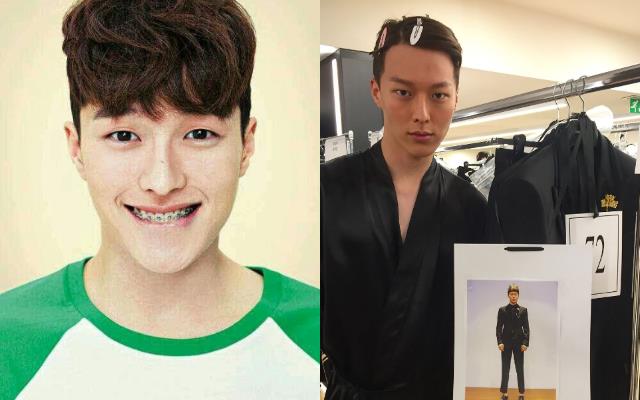 铁粉才知道!雕刻美男“张基龙”的小秘密:牙套曾是个人特色、嘻哈饶舌、唱情歌都难不倒他! 内容图2 女神网-大潮社TV实时追踪属于女人新资讯的综合网站! 铁粉才知道!雕刻美男“张基龙”的小秘密:牙套曾是个人特色、嘻哈饶舌、唱情歌都难不倒他! 影视娱乐 图2张