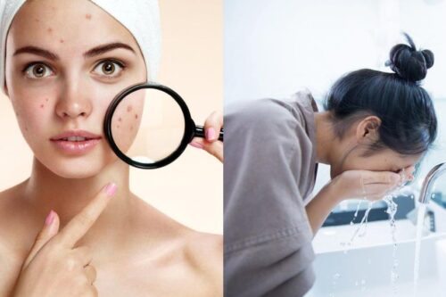 一天到晚冒痘痘，可能跟无意间的小动作有关？改善生活 4 个坏习惯，告别“月球表面”的困扰