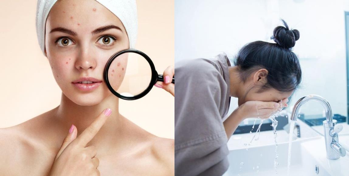 一天到晚冒痘痘,可能跟无意间的小动作有关?改善生活 4 个坏习惯,告别“月球表面”的困扰 内容图1 女神网-大潮社TV实时追踪属于女人新资讯的综合网站! 一天到晚冒痘痘,可能跟无意间的小动作有关?改善生活 4 个坏习惯,告别“月球表面”的困扰 健康养生 图1张