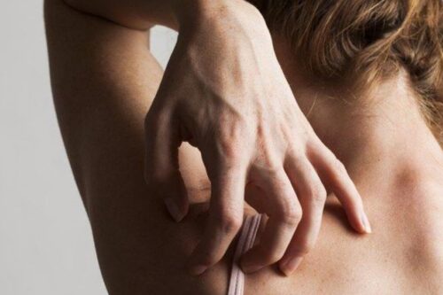 就算皮在痒，也别乱擦药！专业药师提醒：药品涂抹过厚，反而阻塞毛孔