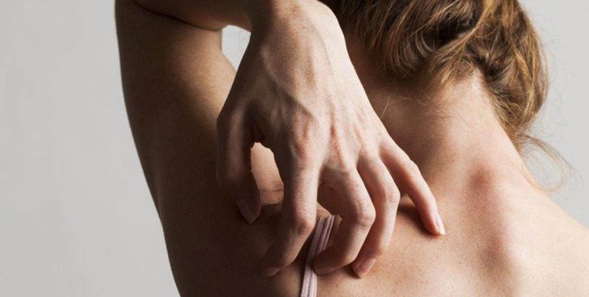 就算皮在痒,也别乱擦药!专业药师提醒:药品涂抹过厚,反而阻塞毛孔 内容图1 女神网-大潮社TV实时追踪属于女人新资讯的综合网站! 就算皮在痒,也别乱擦药!专业药师提醒:药品涂抹过厚,反而阻塞毛孔 健康养生 图1张