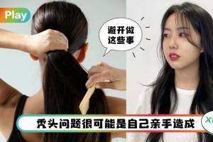 Tips I 清朝人的发际线才不要，这5个坏习惯会让你越来越秃！