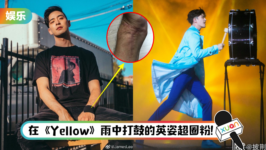 188公分高颜值男星李铢衔《哥哥》爆红 ！6年前曾遇重大意外…左手险遭截肢！