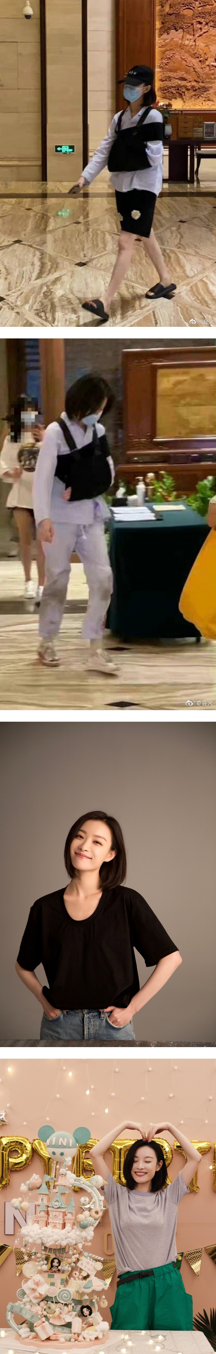 与邓伦合作拍摄新剧...倪妮意外受伤！ 手绑吊带护具仍开工 娱乐资讯 图2张