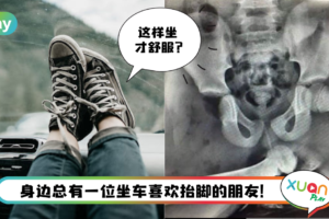 News I 坐副驾千万别抬起双腿！英国女生发生车祸腿骨插进屁股！