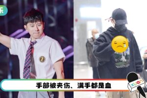 超拼！张杰高空摔倒照样工作 “手缠纱布”亮相