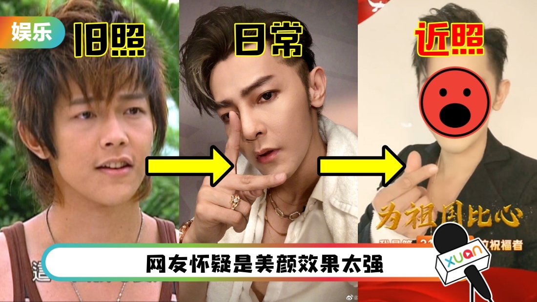 汪东城样貌遭质疑“再进化”!网翻旧照对比…完全就是不同人