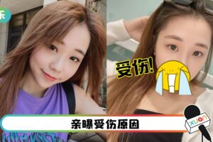 艾薇脸部再受重伤！鼻下+下巴有伤口 吓坏粉丝