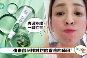 Tips I 痘痘我们分手吧！4种类型痘痘建议这样修复