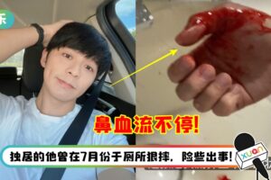 “工作狂”Danny许佳麟熬出病！鼻血流不停 “一度以为我要死了”