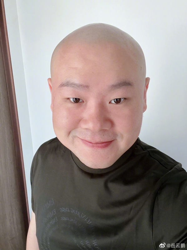 36岁岳云鹏“暴瘦+剃光头”疯传病危！曾透露：身体不舒服 娱乐资讯 图1张