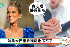 Tips｜53岁歌后Celine Dion传肌肉严重痉挛，都和这5种原因有关