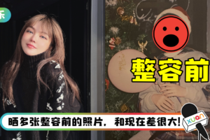 周扬青公开整容前真实样貌！ 大方认：前后长得毫无关联