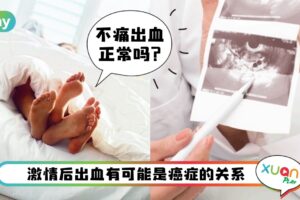 爱爱 I 激情后出血未必小事，有可能是癌症的警讯！