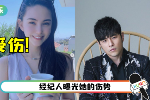 昆凌家中出意外…头部撞伤肿了！ 周杰伦忙着照顾老婆