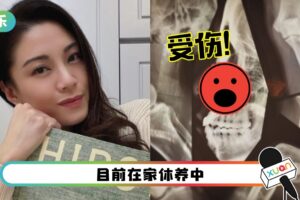 廖碧儿“脸朝地”摔倒…送急诊照X光!第一时间保护鼻子!