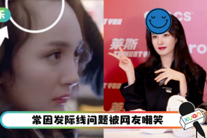 真的去植发了？ 杨幂发量突增多…逆龄回春变少女了