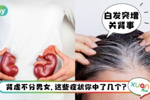 Tips I 经常腰酸、长白发、耳鸣都要注意！这是肾虚症状来的