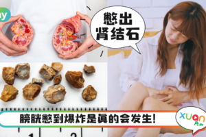Tips｜还会导致不孕？知道这5个憋尿坏处后看你还敢不敢？