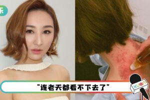 连续工作4月 体力严重透支！高海宁扭伤肩颈