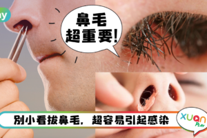 健康｜鼻毛太长该剪还是该拔？医警告：小心导致脑脓疡！