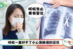 健康 I 这样咳嗽别大意！肺癌的咳嗽都有4个特点