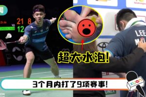 脚板冒出超大血泡…李梓嘉因伤退出世锦赛！赛后爆哭引网心疼