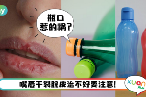 生活｜嘴唇干裂总是好不起来？可能和你使用的水瓶有关系！