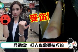 Yumi黄诗棋拍动作戏导致手掌擦伤+膝盖淤青！ “打人的是我，受伤的还是我”