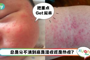 Tips I 湿疹和热疹别傻傻分不清！几点轻松识别两者的区别