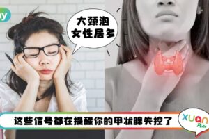 健康 I 突然瘦了别急着开心！甲亢症状早期10种身体表现