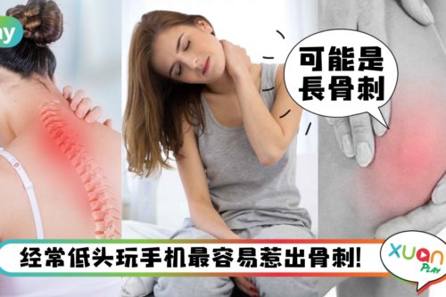 生活|不是普通颈椎痛,久坐久站的上班族可能长骨刺了!