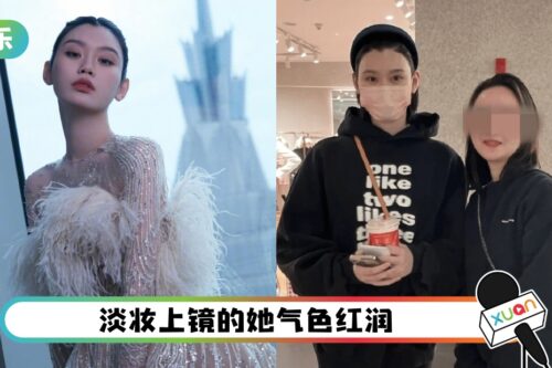 奚梦瑶产二胎后被偶遇！看她那双腿吓坏了